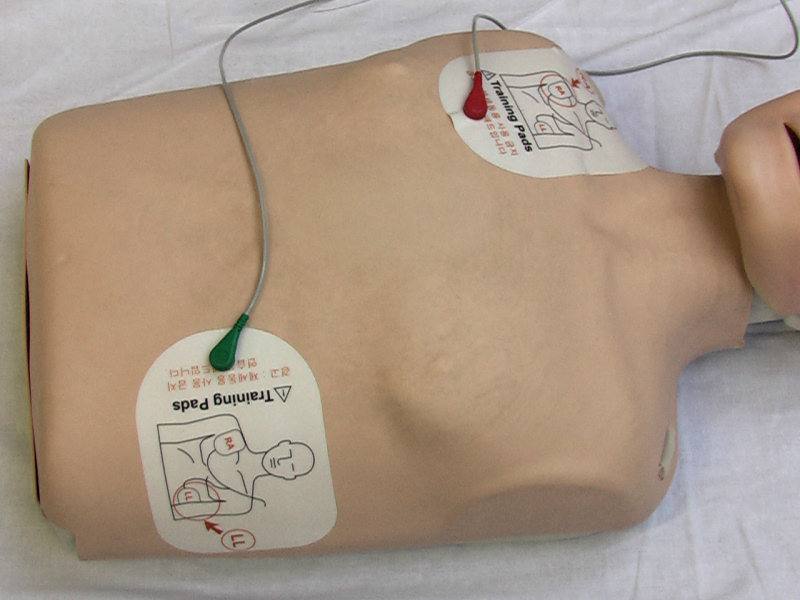 Přiložení elektrod u AED